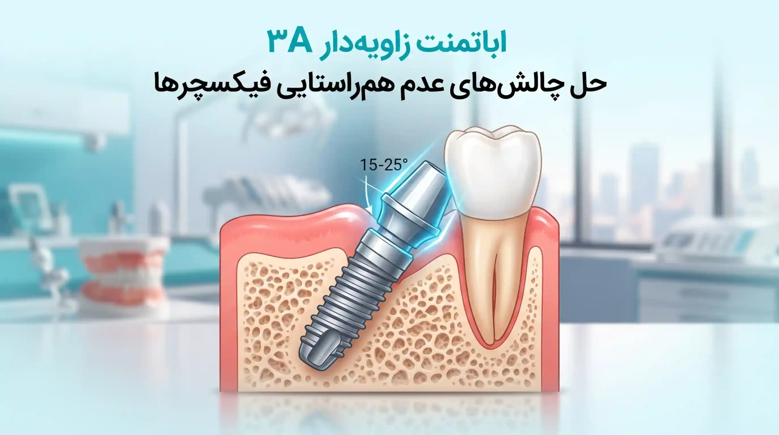 ↗️ اباتمنت زاویهدار ۳A حل چالشهای عدم همراستایی فیکسچرها
